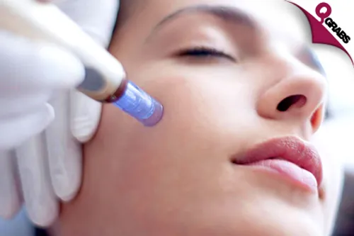 From QR650 Receive PRP Sessions for Scalp OR Dermapen Sessions for Face OR PRP with Dermapen Sessions for Face - for HIM or HER! (Up to QR7500 Value)